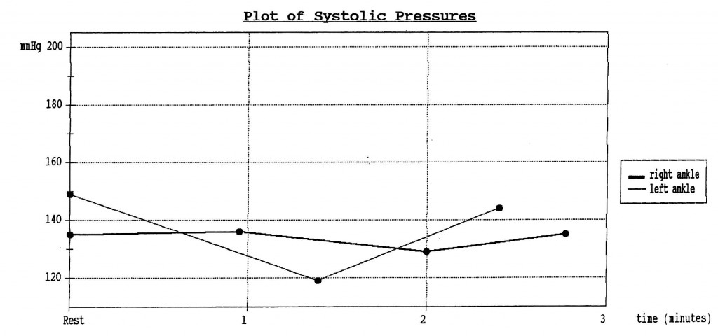 Plot of Systolic Pressures