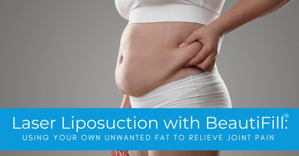 The BeautiFILL System: Using Your Body’s Own Fat to Relieve Joint Pain