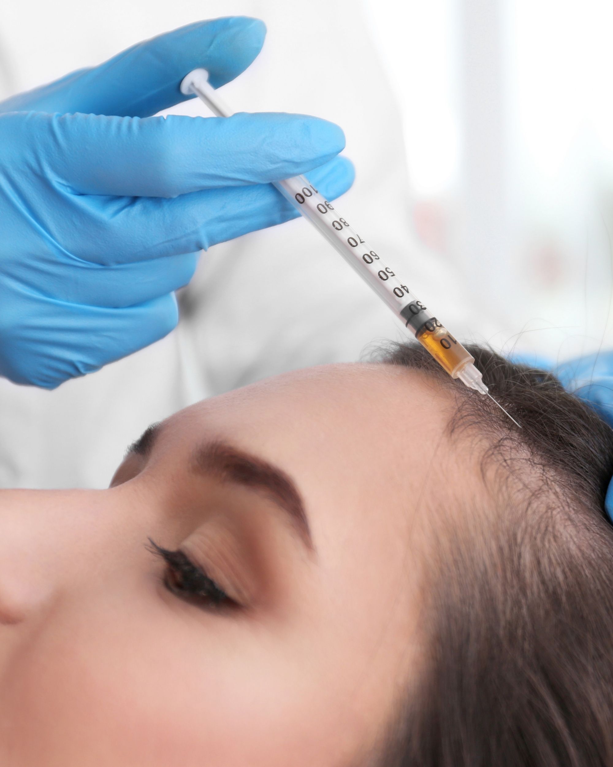 hair loss treatment in greenville sc